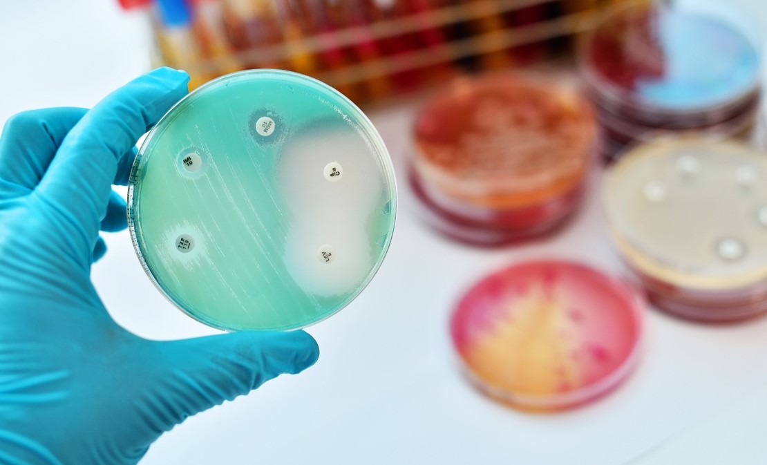 Crossing boundaries to tackle antimicrobial resistance